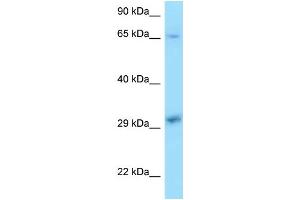 WB Suggested Anti-XPA Antibody Titration: 1. (XPA antibody  (C-Term))