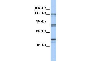 WB Suggested Anti-CSE1L Antibody Titration:  0. (Exportin 2 antibody  (N-Term))