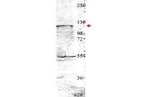 Western blot using NEDD4 polyclonal antibody  shows detection of a 115 kDa band corresponding to endogenous NEDD4 (arrowhead) in MDA-MB-435 cell lysates. (NEDD4 antibody  (Internal Region))