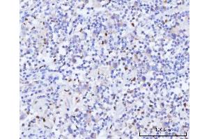 IHC analysis of RAD51C using anti-RAD51C antibody (ABIN7599718).