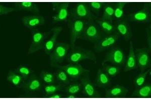 Immunofluorescence analysis of A549 cells using RFC1 Polyclonal Antibody