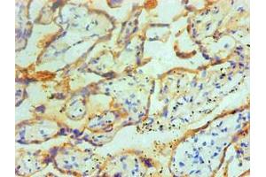 Immunohistochemical of paraffin-embedded Human placenta tissue using ABIN7166415 at dilution of 1:200. (Transglutaminase 2 antibody)