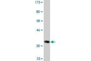 Western Blot detection against Immunogen (36. (DICER1 antibody  (AA 1813-1912))