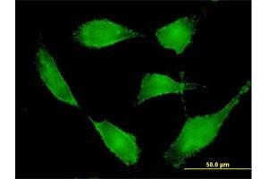 Immunofluorescence of purified MaxPab antibody to BSG on HeLa cell. (CD147 antibody  (AA 1-269))