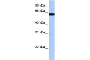 Western Blotting (WB) image for anti-RNA Binding Motif Protein 14 (RBM14) antibody (ABIN2462204) (RBM14 antibody)
