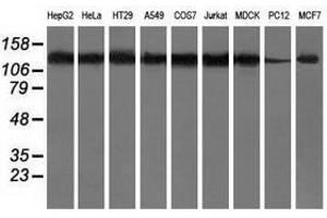 Image no. 2 for anti-Histone Deacetylase 6 (HDAC6) antibody (ABIN1498620) (HDAC6 antibody)
