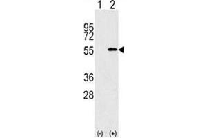Western blot analysis of NUP50 antibody and 293 cell lysate (2 ug/lane) either nontransfected (Lane 1) or transiently transfected with the NUP50 gene (2). (NUP50 antibody  (AA 432-461))