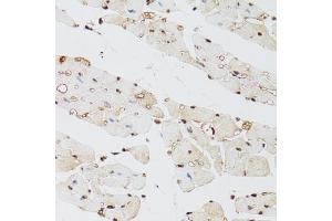 Immunohistochemistry (IHC) image for anti-Lysine (K)-Specific Demethylase 4A (KDM4A) (AA 585-815) antibody (ABIN6142793)