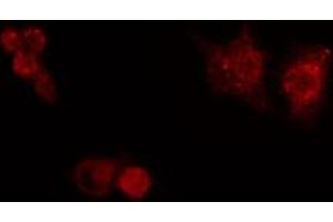ABIN6272434 staining HuvEc by IF/ICC. (Splicing Factor 1 antibody  (N-Term))