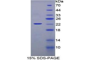 SDS-PAGE of Protein Standard from the Kit (Highly purified E. (IFNA CLIA Kit)