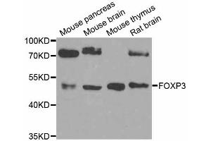 Western blot analysis of extracts of various cell lines, using FOXP3 antibody (ABIN5974993) at 1/1000 dilution. (FOXP3 antibody)