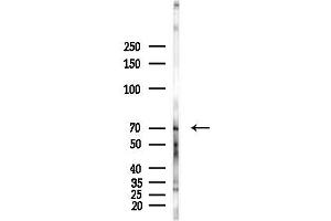 Western blot analysis of lysates from Hela cells(heat-shock,45 min treatment), using C Antibody at 1/1000 dilution.