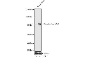Western blot analysis of extracts of Mouse brain, using Phospho-Tau-S262 antibody (ABIN3020339, ABIN3020340, ABIN3020341 and ABIN7101872) at 1:500 dilution. (MAPT antibody  (pSer262))
