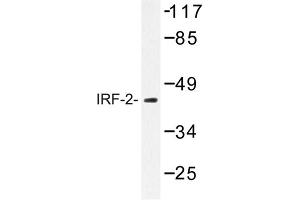Image no. 1 for anti-Interferon Regulatory Factor 2 (IRF2) antibody (ABIN272167)