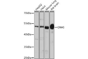 Western blot analysis of extracts of various cell lines, using GNAS antibody (ABIN6127959, ABIN6141213, ABIN6141214 and ABIN6221191) at 1:1000 dilution. (GNAS antibody  (AA 1-394))