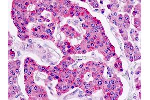Human, Pancreas, Islets: Formalin-Fixed Paraffin-Embedded (FFPE) (LGR5 antibody  (N-Term))