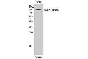 Western Blotting (WB) image for anti-Mitogen-Activated Protein Kinase 8 Interacting Protein 1 (MAPK8IP1) (pThr103) antibody (ABIN3182443) (MAPK8IP1 antibody  (pThr103))