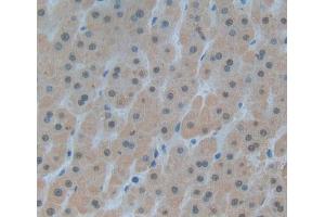 Used in DAB staining on fromalin fixed paraffin- embedded liver tissue (DKC1 antibody  (AA 298-465))