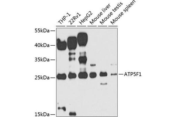ATP5F1 抗体  (AA 1-245)
