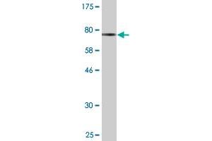 Western Blot detection against Immunogen (73.