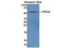 Detection of Recombinant ICAM1, Human using Monoclonal Antibody to Intercellular Adhesion Molecule 1 (ICAM1) (ICAM1 antibody  (AA 41-464))