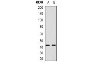 Western blot analysis of PABPC5 expression in U87MG (A), K562 (B) whole cell lysates. (PABPC5 antibody)