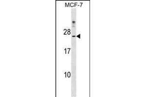 CYB5D1 Antibody (Center) (ABIN1538512 and ABIN2849260) western blot analysis in MCF-7 cell line lysates (35 μg/lane). (CYB5D1 antibody  (AA 59-86))