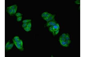 Immunofluorescent analysis of HepG2 cells using ABIN7144247 at dilution of 1:100 and Alexa Fluor 488-congugated AffiniPure Goat Anti-Rabbit IgG(H+L) (ASZ1 antibody  (AA 1-200))