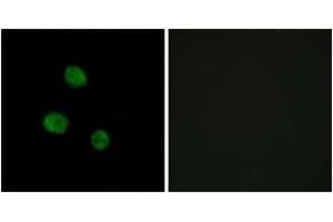 Immunofluorescence analysis of MCF7 cells, using hnRNP M Antibody. (HNRNPM antibody  (AA 11-60))