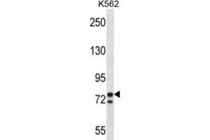 Western Blotting (WB) image for anti-Proprotein Convertase Subtilisin/kexin Type 7 (PCSK7) antibody (ABIN2997695) (PCSK7 antibody)