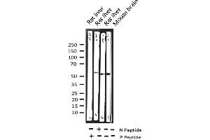 Western Blotting (WB) image for anti-serum/glucocorticoid Regulated Kinase 1 (SGK1) (pSer422) antibody (ABIN6256329)
