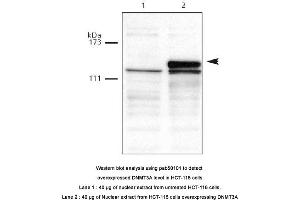 Image no. 1 for anti-Deoxyribonucleic Acid (DNA) (AA 10-118) antibody (ABIN363410) (DNA antibody  (AA 10-118))