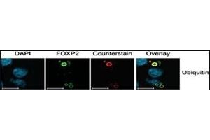 Characterization of FOXP2 Isoforms. (Ubiquitin antibody  (AA 36-66))