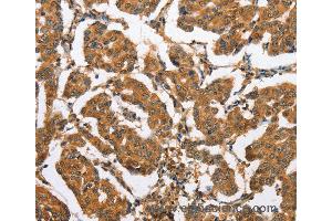 Immunohistochemistry of Human brain  using CXCL14 Polyclonal Antibody at dilution of 1:60 (CXCL14 antibody)