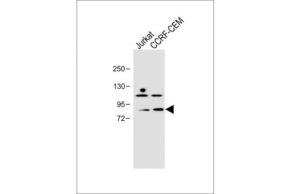 PLK2 antibody  (C-Term)