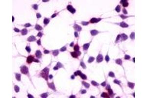Anti-GPRC5A / RAI3 antibody immunocytochemistry (ICC) staining of HEK293 human embryonic kidney cells transfected with GPRC5A / RAI3. (GPRC5A antibody  (N-Term))
