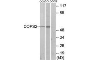 Western blot analysis of extracts from COS7/COLO205 cells, using COPS2 Antibody.