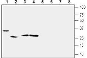 Western blot analysis of mouse heart (lanes 1 and 5), rat skeletal muscle (lanes 2 and 6), rat adipose tissue (lanes 3 and 7) and rat pancreas (lanes 4 and 8): - 1-4. (UCP2 antibody  (Intracellular))