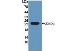 Detection of Recombinant EFNA1, Human using Polyclonal Antibody to Ephrin A1 (EFNA1) (Ephrin A1 antibody  (AA 19-182))