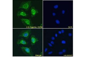 ABIN185364 Immunofluorescence analysis of paraformaldehyde fixed HeLa cells, permeabilized with 0. (Asporin antibody  (Internal Region))