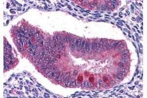 Immunohistochemistry (IHC) image for anti-Forkhead Box O3 (FOXO3) (C-Term) antibody (ABIN185248)