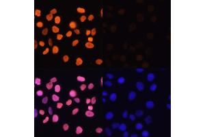 Immunofluorescence analysis of HeLa cells using Acetyl-Histone H3-K4 antibody (ABIN7267672) at dilution of 1:100. (Histone 3 antibody  (H3K4))