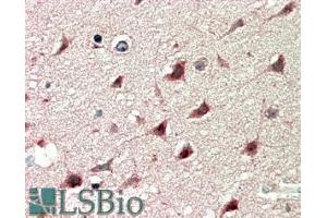 ABIN185538 (5µg/ml) staining of paraffin embedded Human Cerebral Cortex. (DCDC2 antibody  (Internal Region))