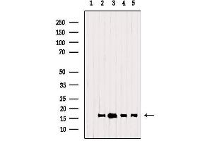 Western blot analysis of extracts from various samples, using TSPO Antibody. (TSPO antibody  (C-Term))