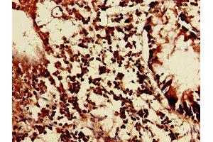 Immunohistochemistry of paraffin-embedded human appendix tissue using ABIN7158291 at dilution of 1:100 (LAIR1 antibody  (AA 22-165))