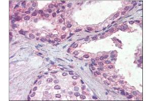 Human Prostate (formalin-fixed, paraffin-embedded) stained with IFNAR2followed by biotinylated anti-goat IgG secondary antibody, alkaline phosphatase-streptavidin and chromogen. (IFNAR2 antibody  (Internal Region))