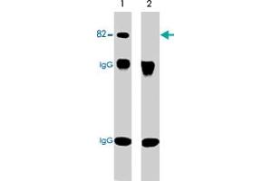 Western blot analysis of immunoprecipitates from neonatal rat brain lysate using anti-PRKCA antibody. (PKC alpha antibody  (pSer657, pTyr658))