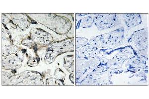 Immunohistochemistry analysis of paraffin-embedded human placenta tissue using PAK1/2 (epitope around residue 199) antibody. (PAK1/2 antibody  (Ser199))