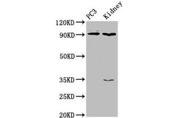 Cyclin-Dependent Kinase 11A (CDK11A) (AA 5-216) antibody