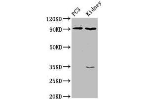 Western Blot Positive WB detected in: PC-3 whole cell lysate, Rat kidney tissue All lanes: CDK11A antibody at 4 μg/mL Secondary Goat polyclonal to rabbit IgG at 1/50000 dilution Predicted band size: 92, 91, 46, 19, 63, 50 kDa Observed band size: 92 kDa (Cyclin-Dependent Kinase 11A (CDK11A) (AA 5-216) antibody)